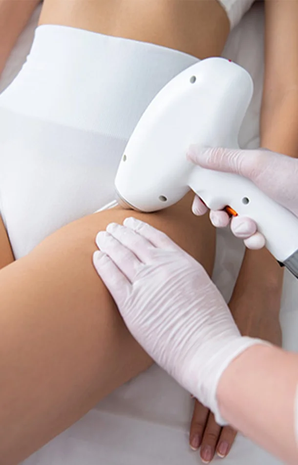 Epilation Laser – 6 séances jambes entières