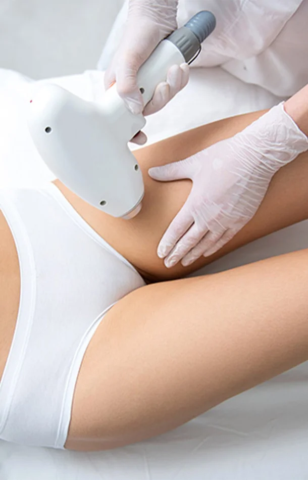 Epilation Laser – 6 séances maillot
